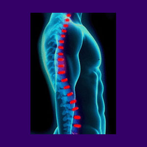 Back Pain Cure