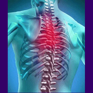 Back Pain Epidemic