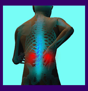 Back Pain in Kidneys