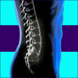 Back Pain Prevention
