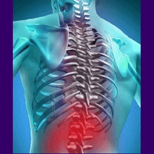 Celebrex for Back Pain