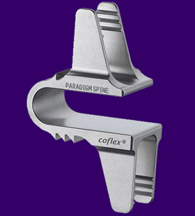 Coflex Implant
