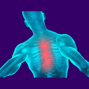 Exercises That Cause Back Pain