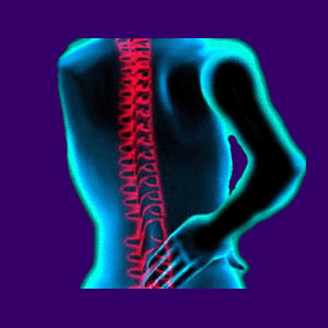 Lasers for Back Pain