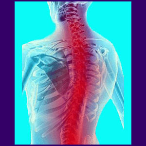 Neurological Consequences of Back Pain