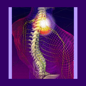 Pinched Nerve Pain