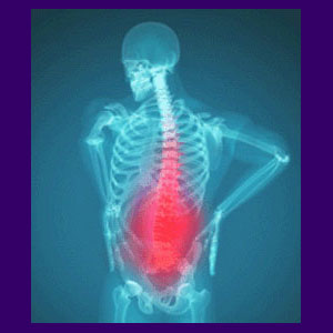 Psychology of Chronic Back Pain