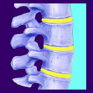 Psychology of Spinal Stenosis