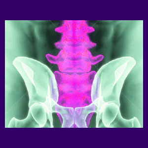 Relief from Sacroiliac Pain