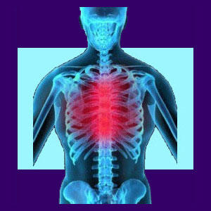Relief from Spinal Stenosis