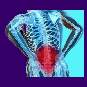 Sciatica Lower Back Pain
