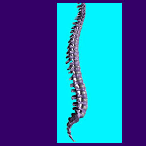 Spinal Arthritis