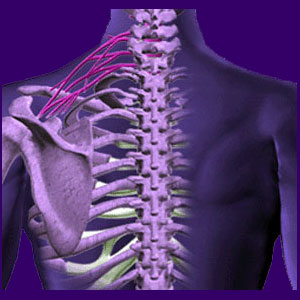 Spinal Nerve Injury