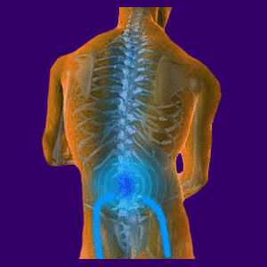 Spinal Stenosis Pain