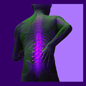 Spinal Stenosis Therapy