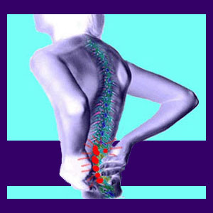 What Causes Lower Back Pain