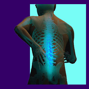 Work Related Back Pain