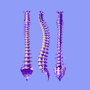 Osteopathy for Sciatica