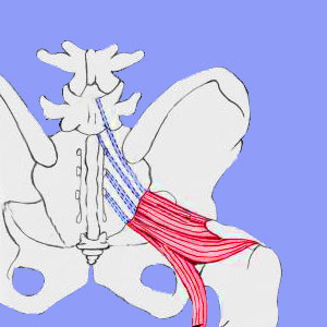 Sciatica Caused by Surgery