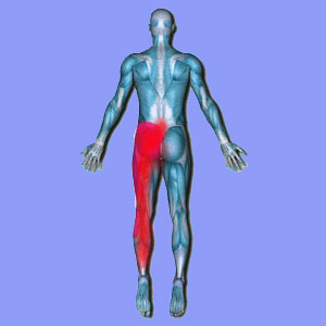 Sciatica in the Back of the Legs