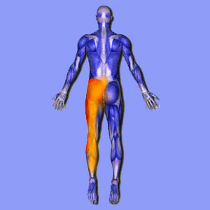 Sciatica Leg Pain